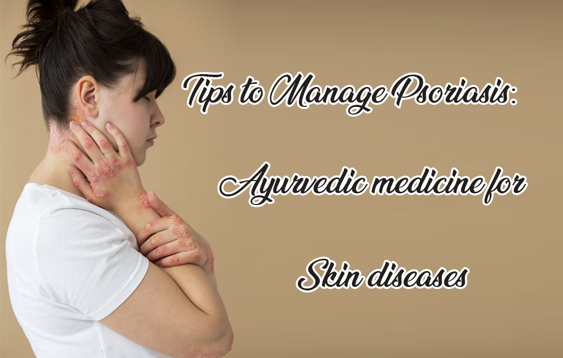 Tips to Manage Psoriasis: Ayurvedic medicine for Skin diseases